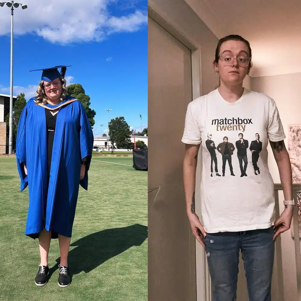 A side-by-side comparison highlights one person’s transformation: on the left, in a blue graduation gown outdoors; on the right, indoors in glasses, jeans, and a Matchbox Twenty T-shirt—reflecting inspiring weight loss success stories Australia celebrates.